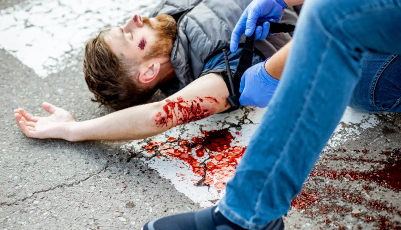 Applying first aid to the injured bleeding man, wearing tourniquet on the arm after the road accident on the pedestrian crossing